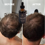 Hair Growth Serum – Anti Hair Loss Treatment & Scalp Nourishing Oil