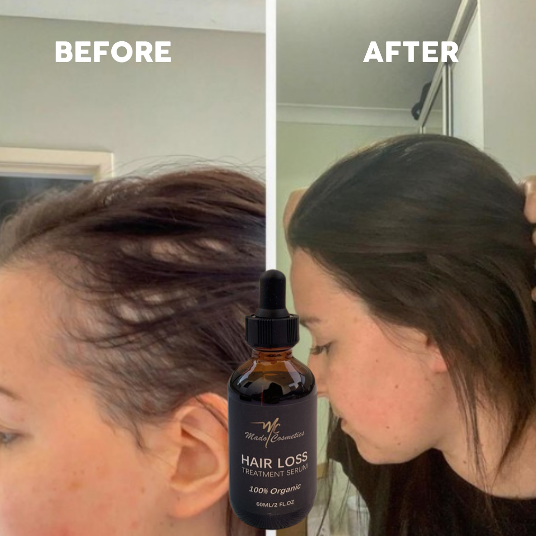 Hair Growth Serum – Anti Hair Loss Treatment & Scalp Nourishing Oil