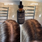 Hair Growth Serum – Anti Hair Loss Treatment & Scalp Nourishing Oil